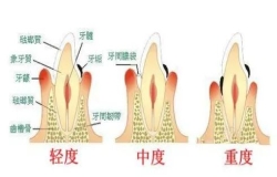 “心口”相依|牙周炎竟与全身这么多疾病有关......